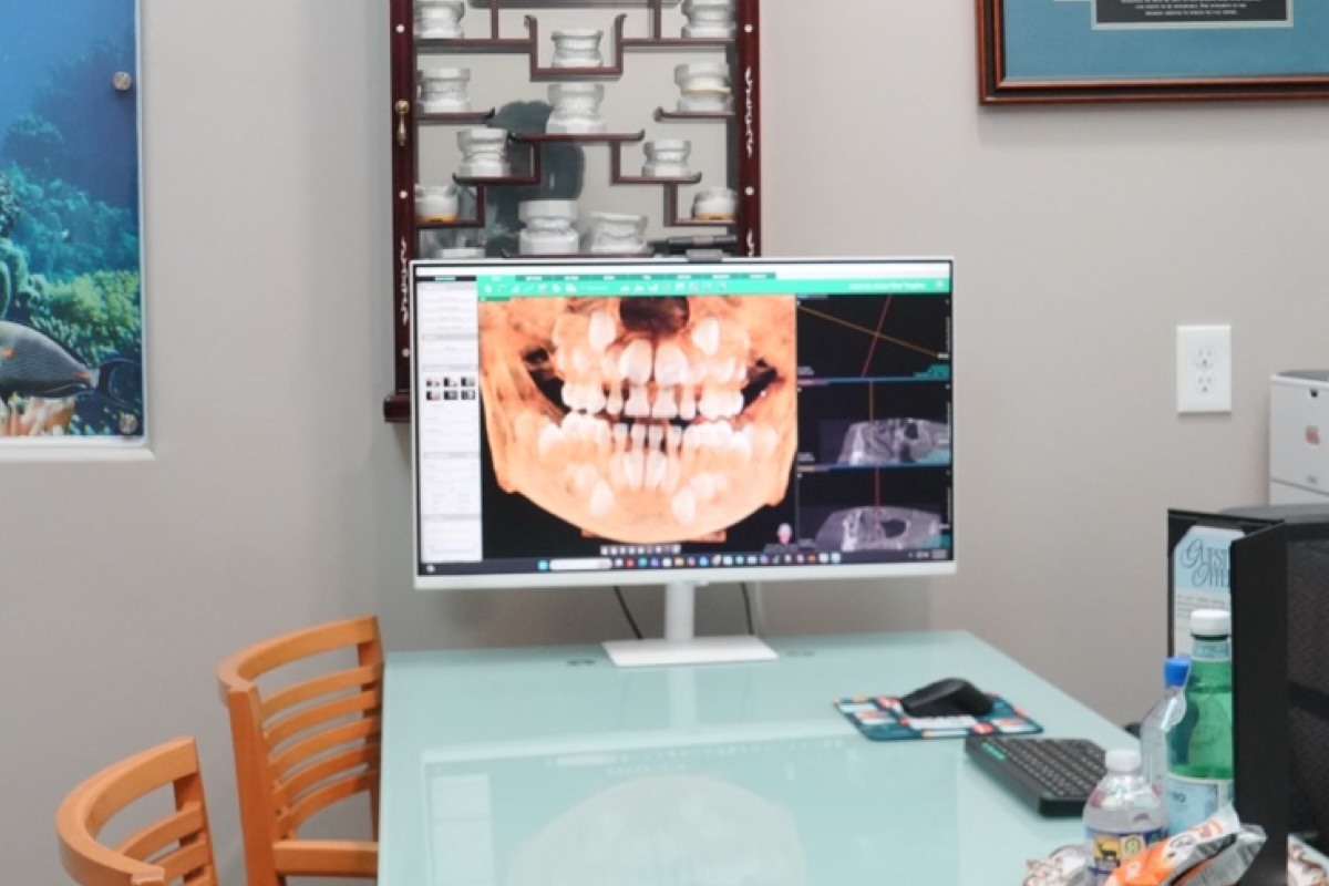 CBCT 3D dental imaging on screen in the iCare consultation room, Norcross, GA